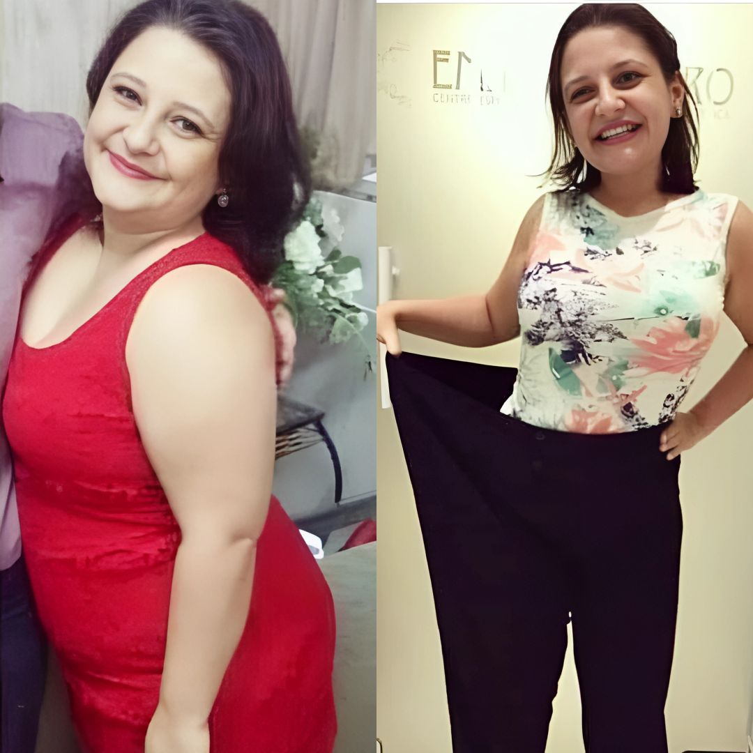 Transformação Antes e Depois 2